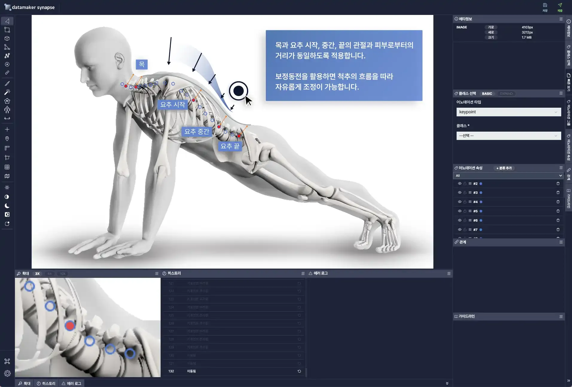 근골격계 질환 디지털 치료